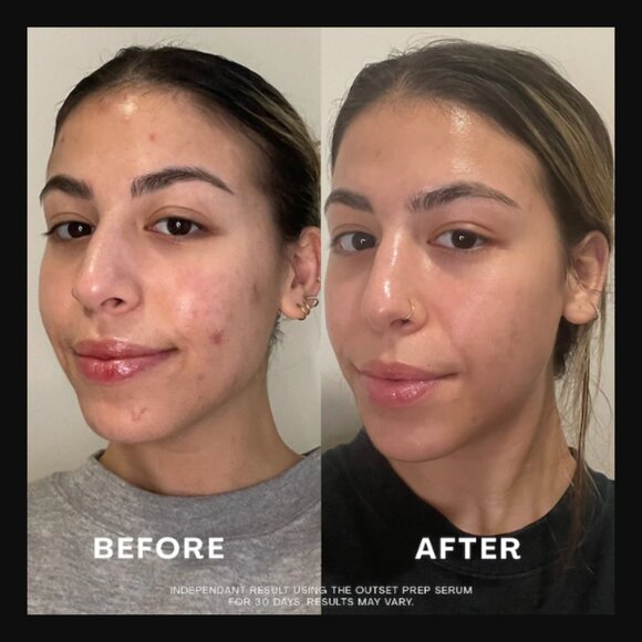 🔥3/$30 NIB The Outset Firming Plumping Vegan Collagen Prep Serum Travel $20.00 - Picture 11 of 11